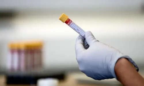 Early blood test to predict dementia is step closer as biological markers identified